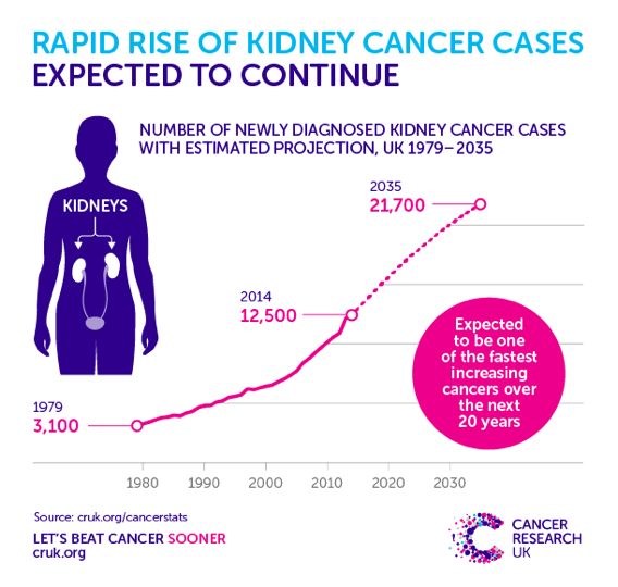 The global incidence of kidney cancer is expected to continue to rise.